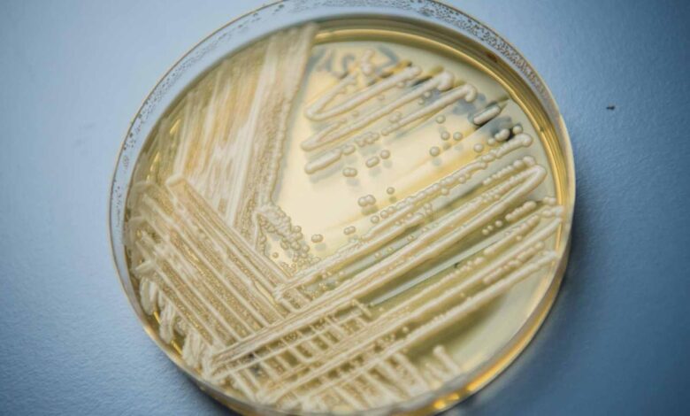 candida-auris-100